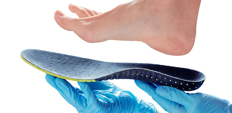 foot with 3d printed insole