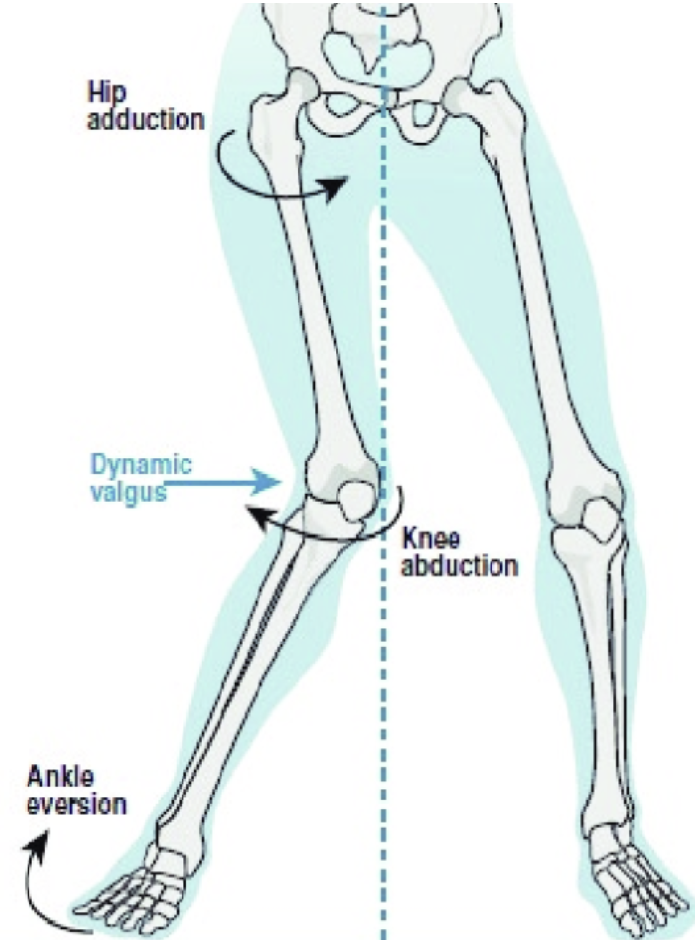 diagram showing hip & knee abduction and ankle eversion
